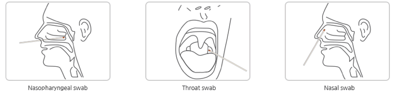 Swabs and COVID-19 – A Guide - Logical Biological