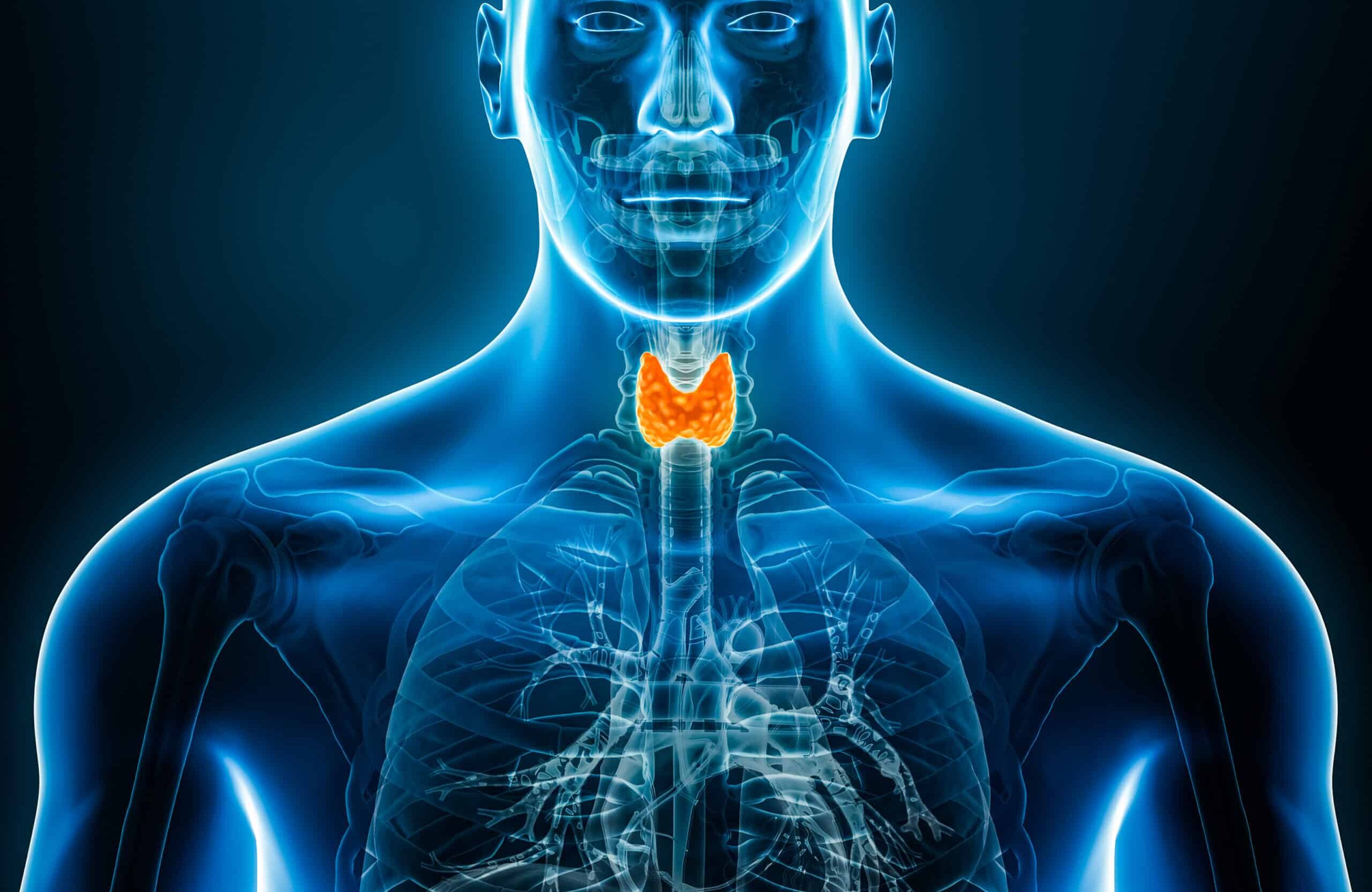 Thyroid Biospecimens