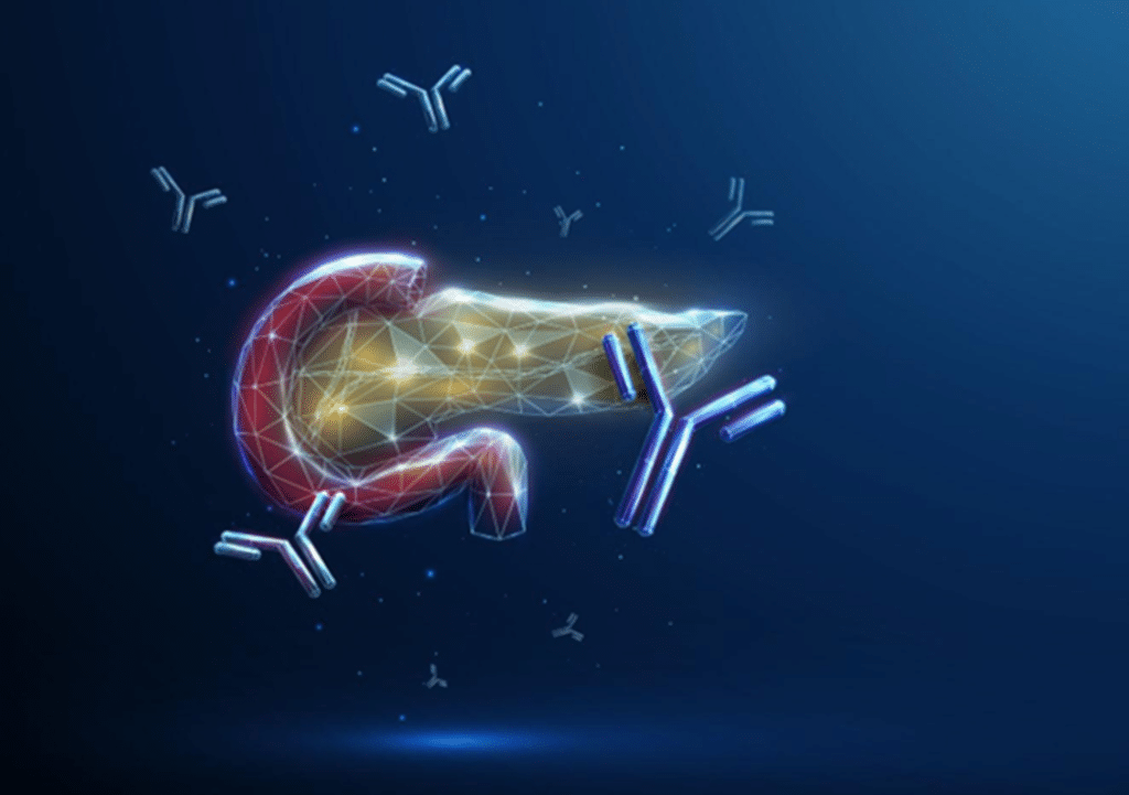 Autoimmune Diabetes Pancreas and antibodies