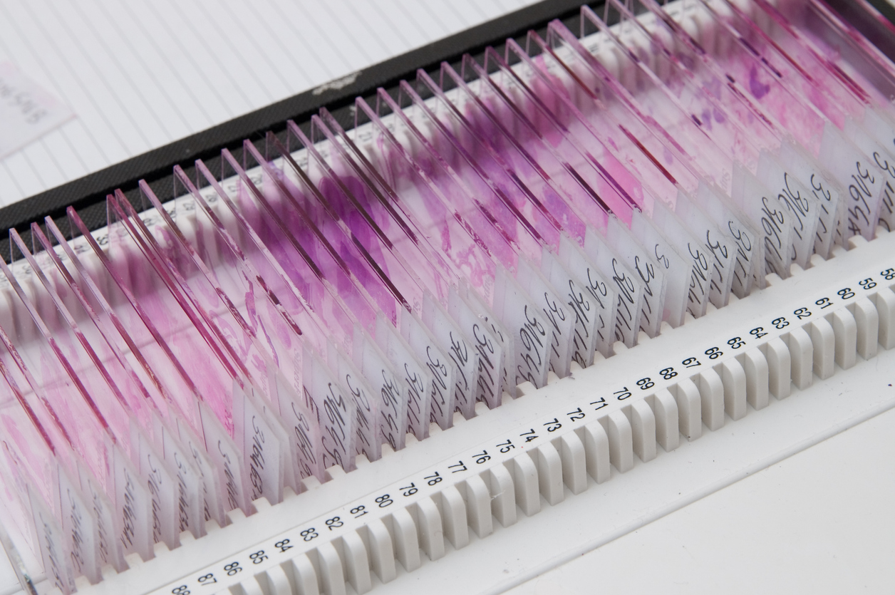 FFPE Tissue slides in container