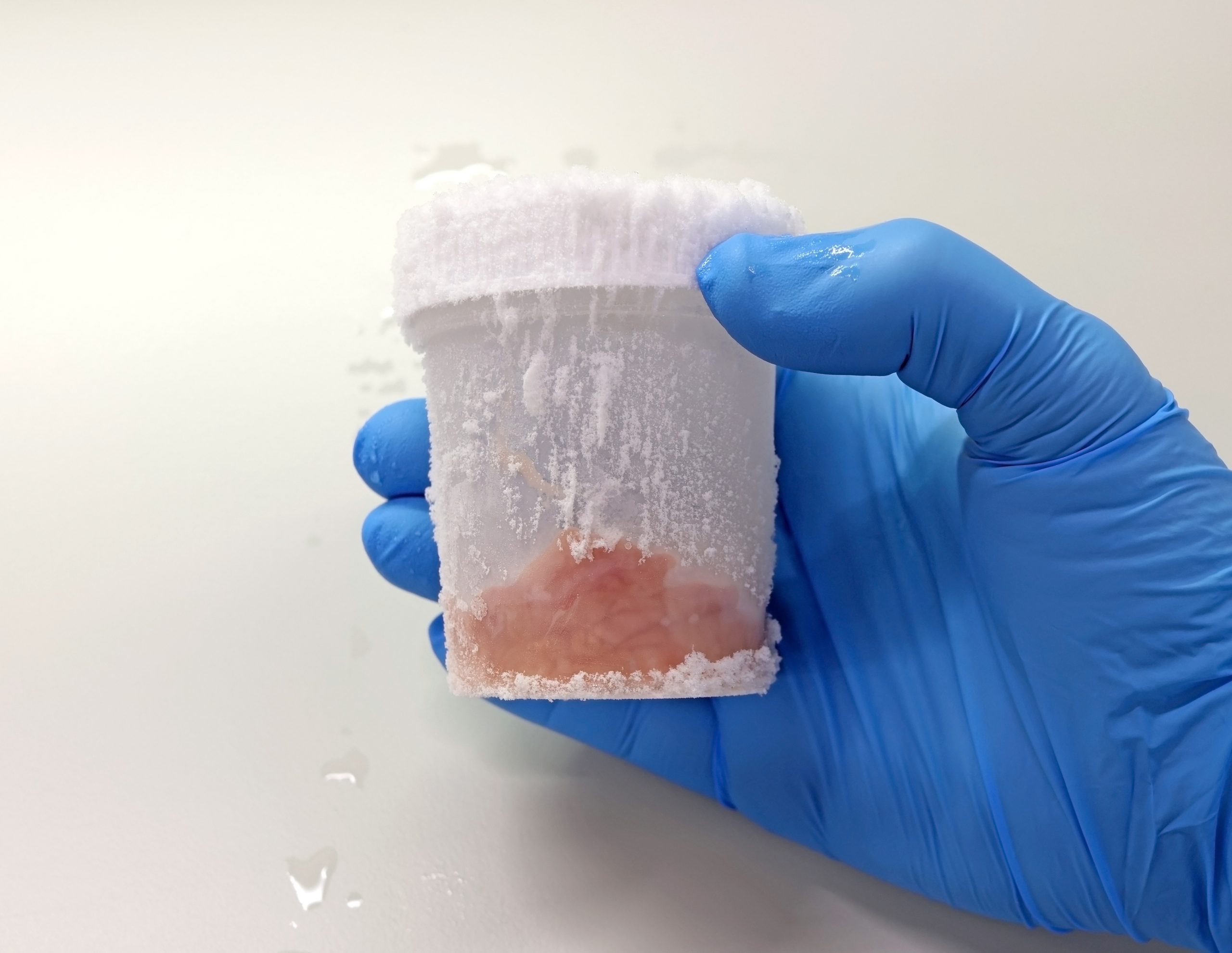 Fresh Frozen Tissue