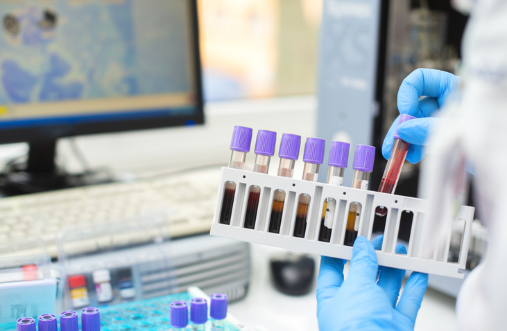 EDTA Plasma Blood tubes collection