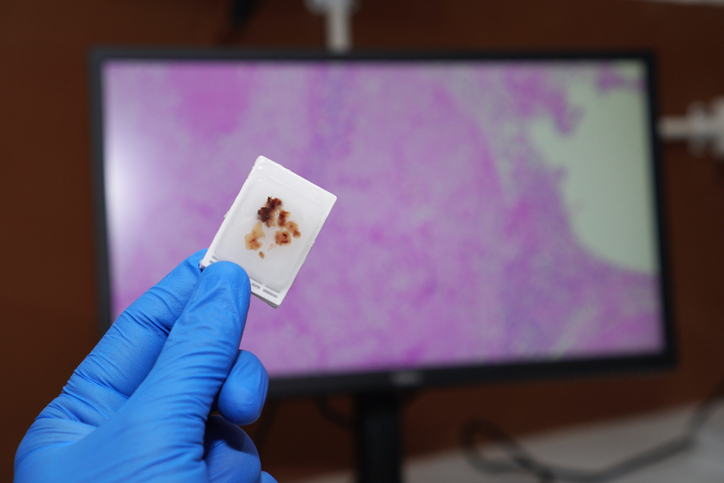 FFPE Tissue block