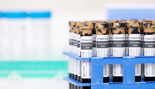 Liquid Biopsy sample