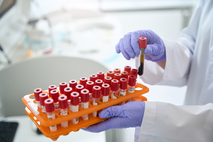 Plasma samples
